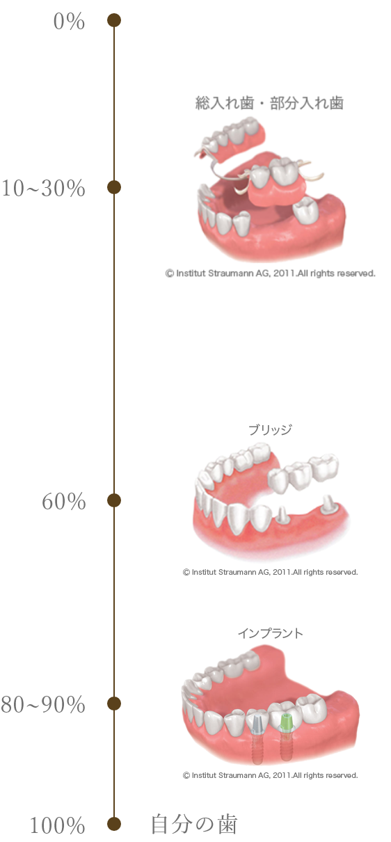 自分の歯：100％、インプラント：80～90％、ブリッジ：60％、総入れ歯・部分入れ歯：10～30％